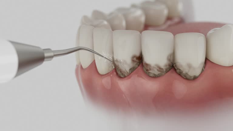 Reliable Emergency Dentist contractor in Jackson, GA by Smile Center Dentistry